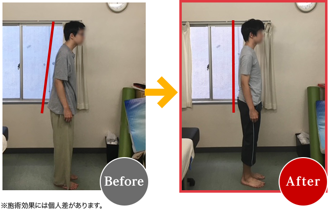 Before After